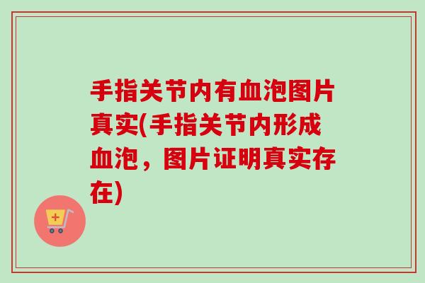 手指关节内有血泡图片真实(手指关节内形成血泡，图片证明真实存在)
