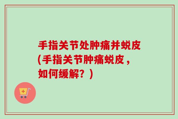 手指关节处肿痛并蜕皮(手指关节肿痛蜕皮，如何缓解？)