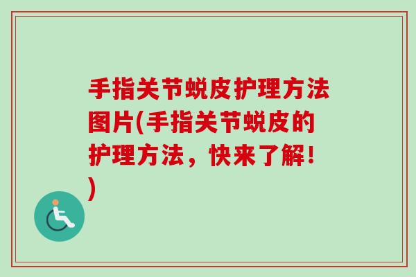 手指关节蜕皮护理方法图片(手指关节蜕皮的护理方法，快来了解！)