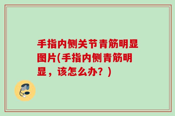 手指内侧关节青筋明显图片(手指内侧青筋明显，该怎么办？)