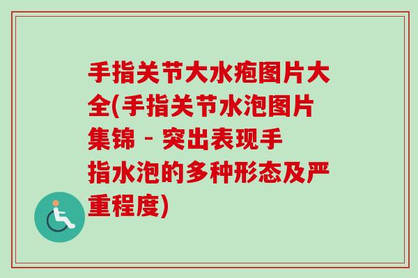 手指关节大水疱图片大全(手指关节水泡图片集锦 - 突出表现手指水泡的多种形态及严重程度)