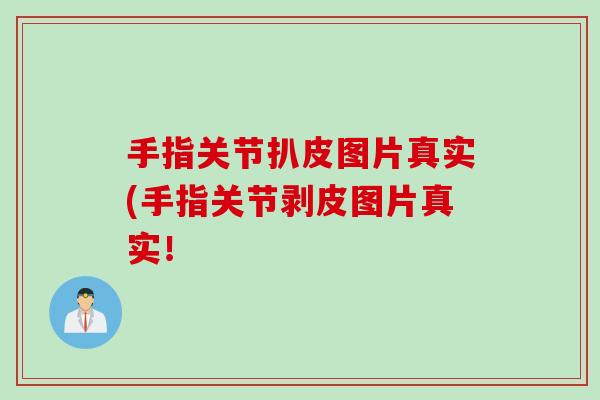 手指关节扒皮图片真实(手指关节剥皮图片真实！