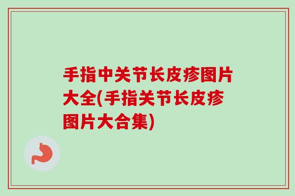 手指中关节长皮疹图片大全(手指关节长皮疹图片大合集)