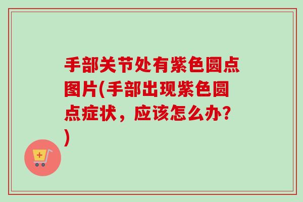 手部关节处有紫色圆点图片(手部出现紫色圆点症状，应该怎么办？)