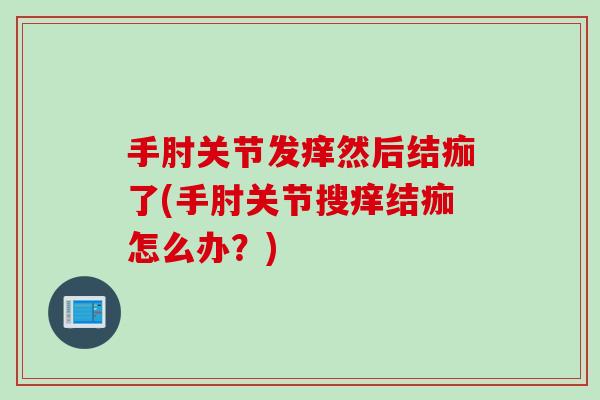 手肘关节发痒然后结痂了(手肘关节搜痒结痂怎么办？)