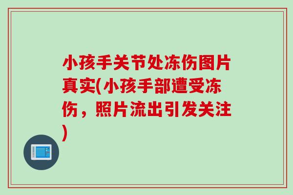小孩手关节处冻伤图片真实(小孩手部遭受冻伤，照片流出引发关注)