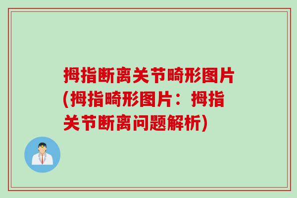 拇指断离关节畸形图片(拇指畸形图片：拇指关节断离问题解析)