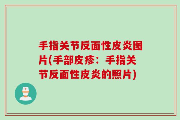 手指关节反面性皮炎图片(手部皮疹：手指关节反面性皮炎的照片)