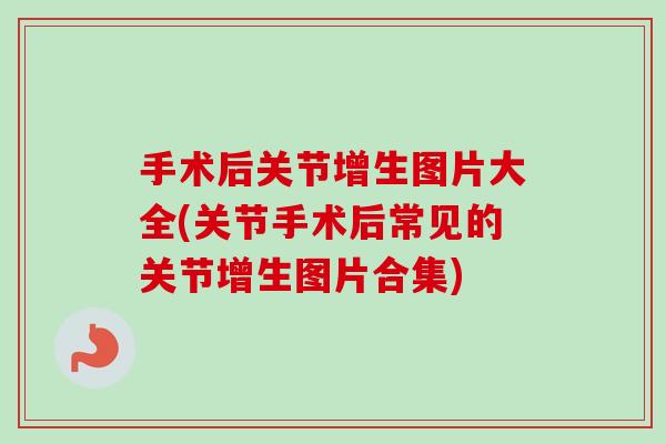 手术后关节增生图片大全(关节手术后常见的关节增生图片合集)