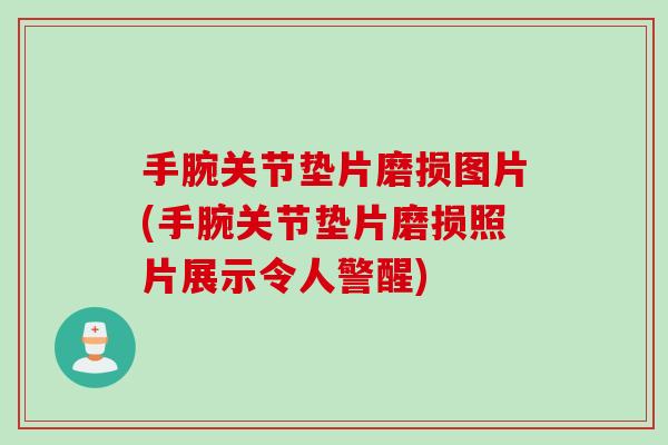 手腕关节垫片磨损图片(手腕关节垫片磨损照片展示令人警醒)