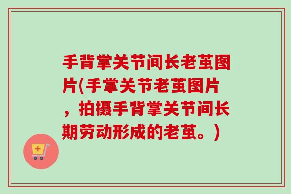 手背掌关节间长老茧图片(手掌关节老茧图片，拍摄手背掌关节间长期劳动形成的老茧。)