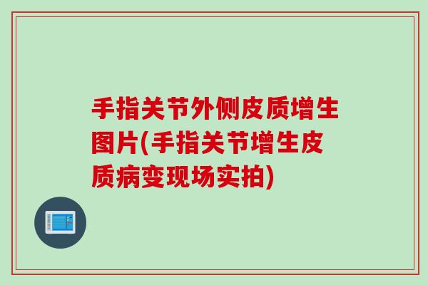 手指关节外侧皮质增生图片(手指关节增生皮质病变现场实拍)