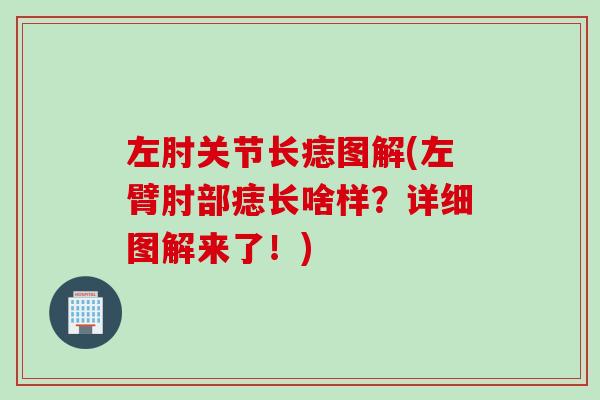 左肘关节长痣图解(左臂肘部痣长啥样？详细图解来了！)