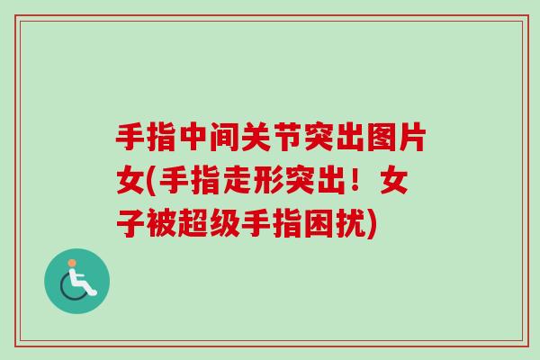 手指中间关节突出图片女(手指走形突出!女子被超级手指困扰) 手指中间关节突出图片女(手指走形突出!女子被超级手指困扰)