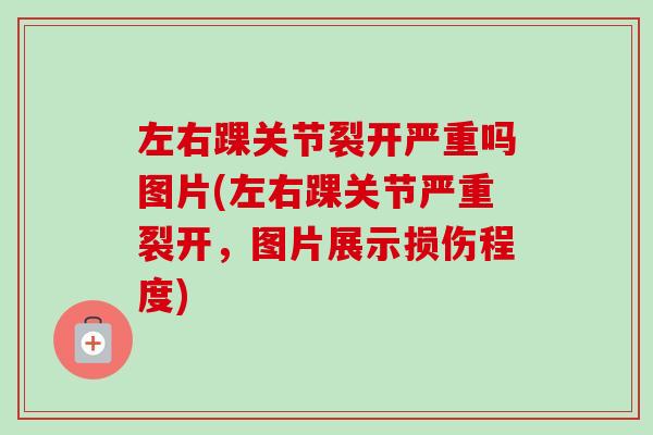 左右踝关节裂开严重吗图片(左右踝关节严重裂开，图片展示损伤程度)