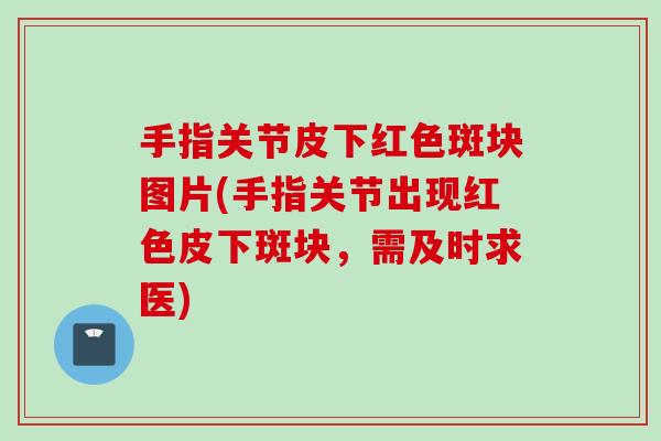 手指关节皮下红色斑块图片(手指关节出现红色皮下斑块，需及时求医)