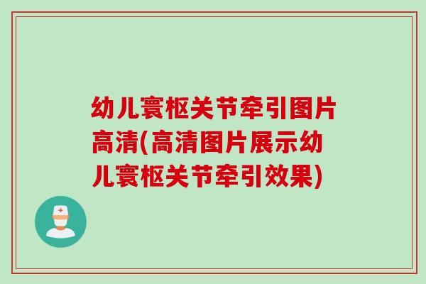 幼儿寰枢关节牵引图片高清(高清图片展示幼儿寰枢关节牵引效果)