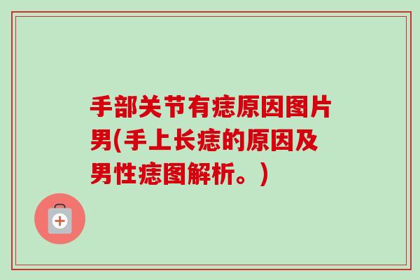 手部关节有痣原因图片男(手上长痣的原因及男性痣图解析。)