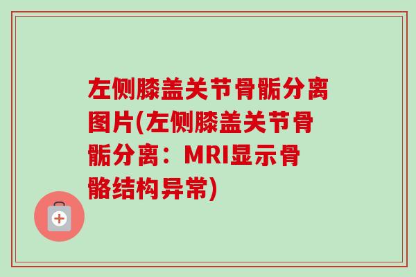 左侧膝盖关节骨骺分离图片(左侧膝盖关节骨骺分离：MRI显示骨骼结构异常)