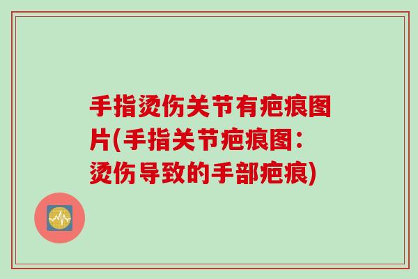 手指烫伤关节有疤痕图片(手指关节疤痕图：烫伤导致的手部疤痕)