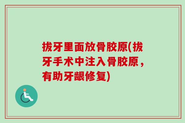 拔牙里面放骨胶原(拔牙手术中注入骨胶原，有助牙龈修复)