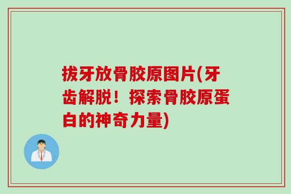 拔牙放骨胶原图片(牙齿解脱！探索骨胶原蛋白的神奇力量)