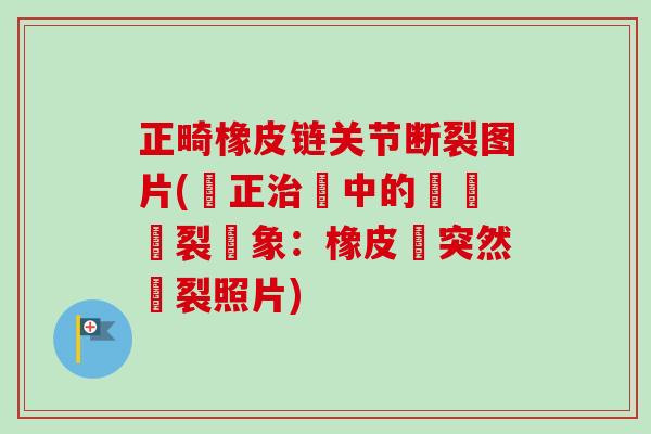 正畸橡皮链关节断裂图片(矯正治療中的關節斷裂現象：橡皮鏈突然斷裂照片)