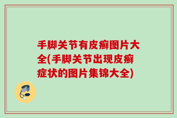 手脚关节有皮癣图片大全(手脚关节出现皮癣症状的图片集锦大全)