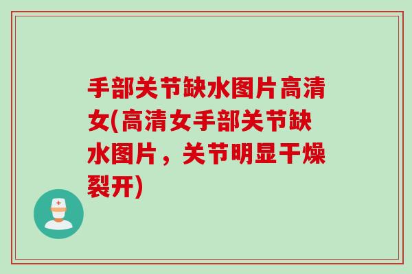 手部关节缺水图片高清女(高清女手部关节缺水图片，关节明显干燥裂开)