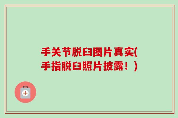 手关节脱臼图片真实(手指脱臼照片披露！)