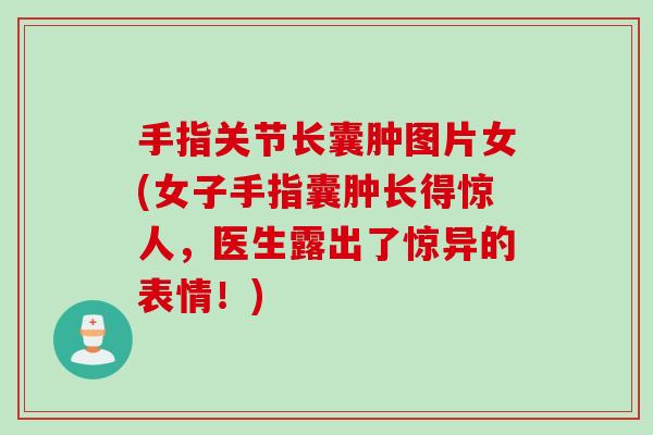 手指关节长囊肿图片女(女子手指囊肿长得惊人，医生露出了惊异的表情！)
