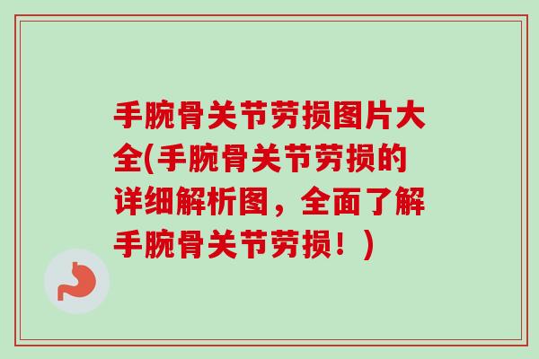 手腕骨关节劳损图片大全(手腕骨关节劳损的详细解析图，全面了解手腕骨关节劳损！)