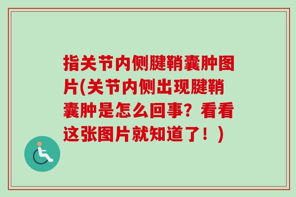 指关节内侧腱鞘囊肿图片(关节内侧出现腱鞘囊肿是怎么回事？看看这张图片就知道了！)