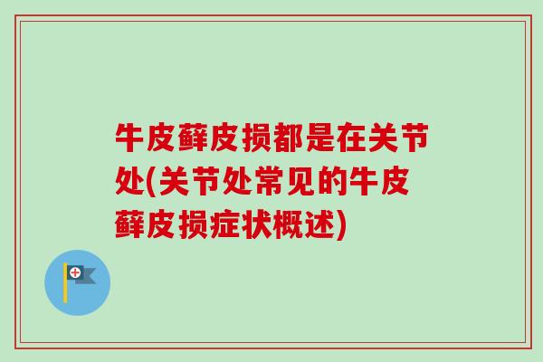 牛皮藓皮损都是在关节处(关节处常见的牛皮藓皮损症状概述)
