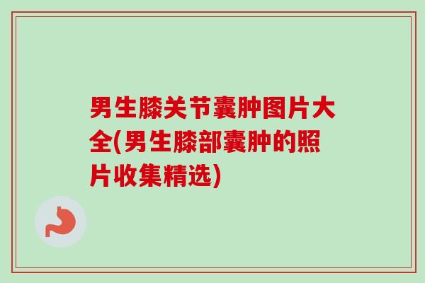 男生膝关节囊肿图片大全(男生膝部囊肿的照片收集精选)