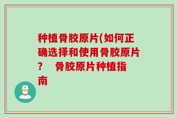 种植骨胶原片(如何正确选择和使用骨胶原片？  骨胶原片种植指南