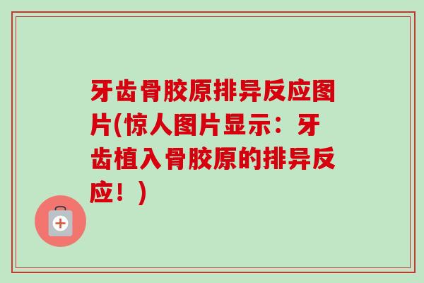 牙齿骨胶原排异反应图片(惊人图片显示：牙齿植入骨胶原的排异反应！)
