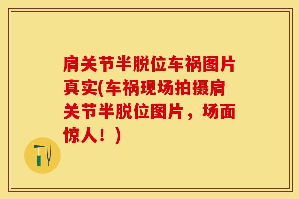 肩关节半脱位车祸图片真实(车祸现场拍摄肩关节半脱位图片，场面惊人！)