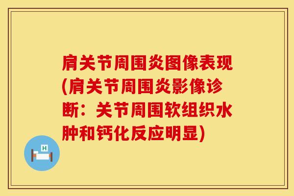 肩关节周围炎图像表现(肩关节周围炎影像诊断：关节周围软组织水肿和钙化反应明显)