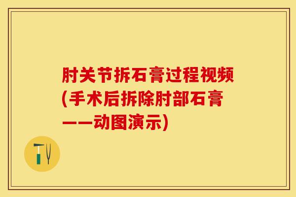 肘关节拆石膏过程视频(手术后拆除肘部石膏——动图演示)