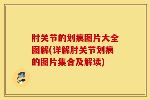 肘关节的划痕图片大全图解(详解肘关节划痕的图片集合及解读)
