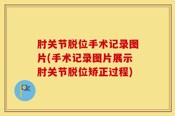 肘关节脱位手术记录图片(手术记录图片展示肘关节脱位矫正过程)