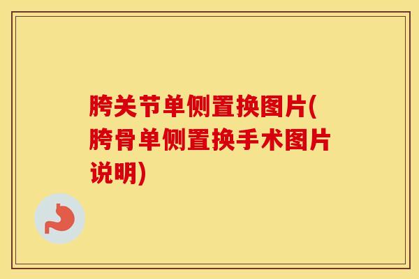 胯关节单侧置换图片(胯骨单侧置换手术图片说明)