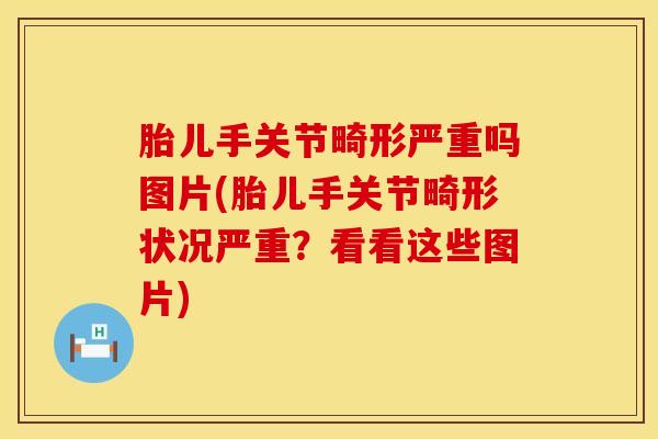 胎儿手关节畸形严重吗图片(胎儿手关节畸形状况严重？看看这些图片)