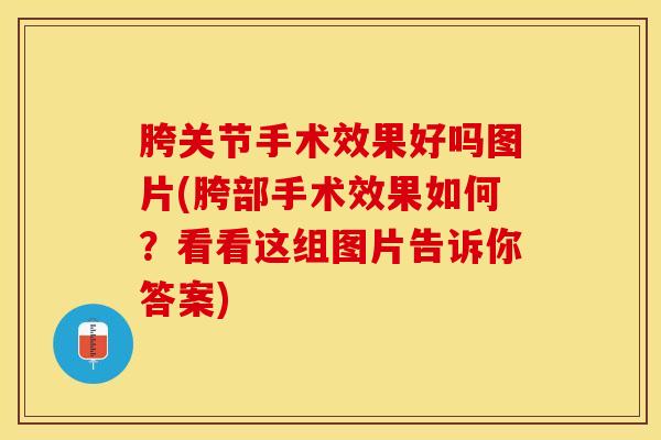 胯关节手术效果好吗图片(胯部手术效果如何？看看这组图片告诉你答案)