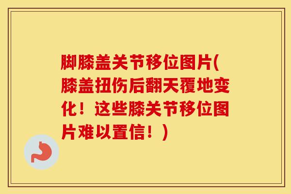 脚膝盖关节移位图片(膝盖扭伤后翻天覆地变化！这些膝关节移位图片难以置信！)