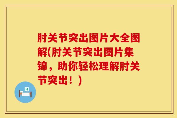 肘关节突出图片大全图解(肘关节突出图片集锦，助你轻松理解肘关节突出！)