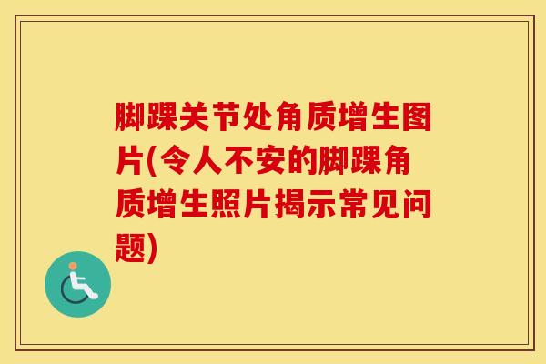 脚踝关节处角质增生图片(令人不安的脚踝角质增生照片揭示常见问题)