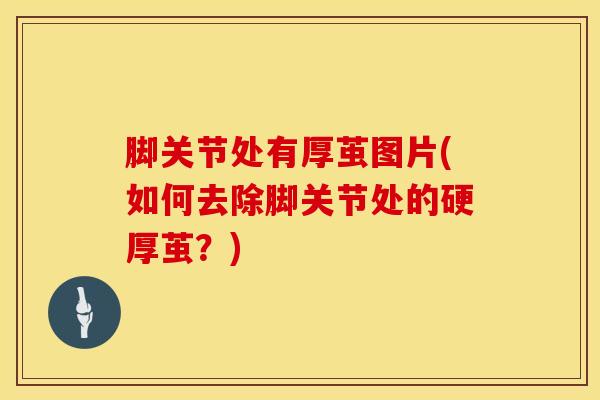 脚关节处有厚茧图片(如何去除脚关节处的硬厚茧？)