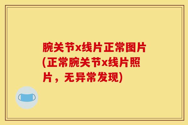 腕关节x线片正常图片(正常腕关节x线片照片，无异常发现)